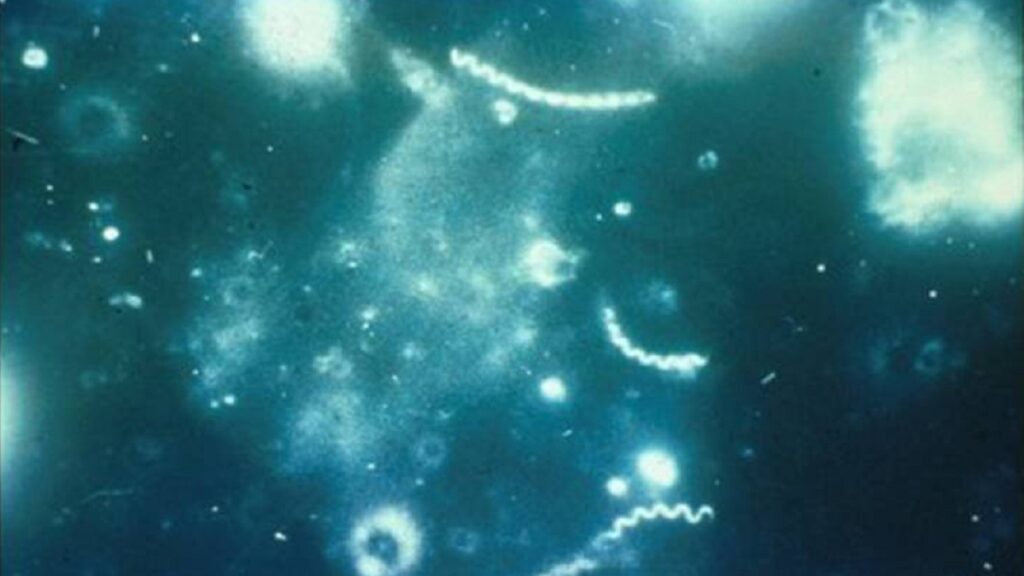 Syphilis: Symptoms, Testing, and Treatment Guide